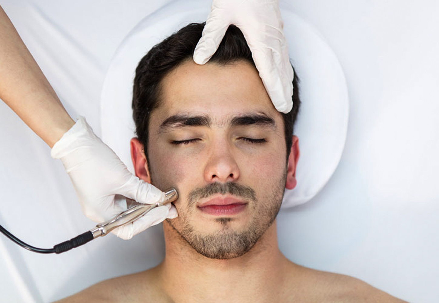 Microdermabrasion Vs. Micro-Needling: What’s The Difference?
